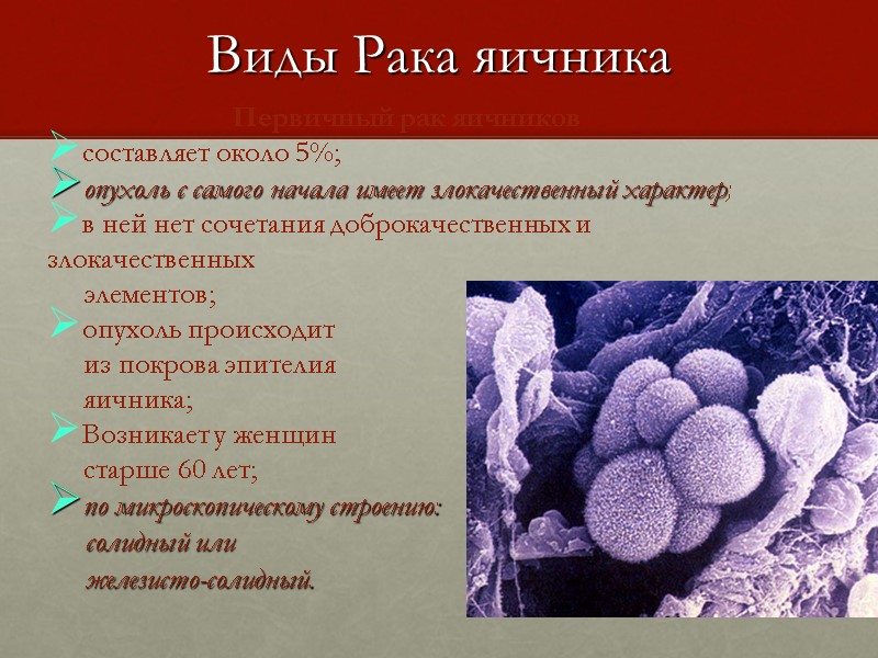 Виды Рака яичника Первичный рак яичников составляет около 5%;  опухоль с самого начала